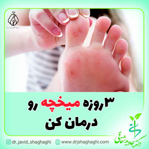 سه روزه میخچه رو درمان کن