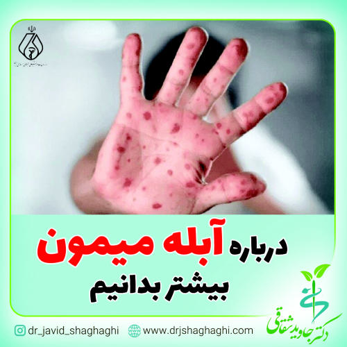 درباره آبله میمون بیشتر بدانیم