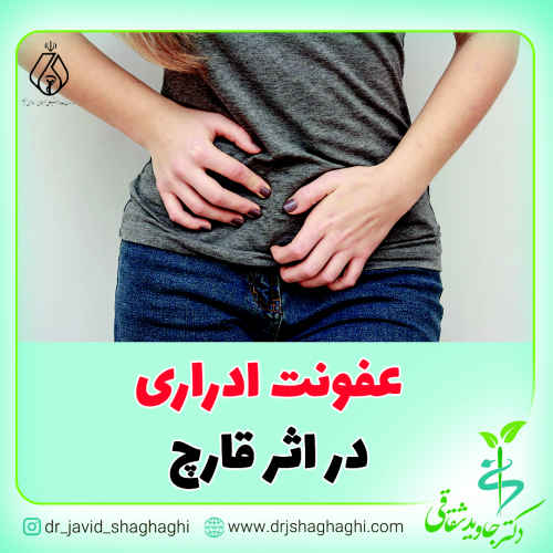 عفونت ادراری در اثر قارچ