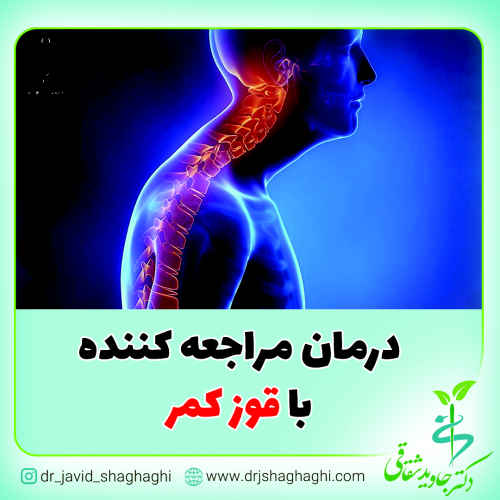 مراجعه کننده با قوز کمر