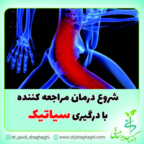 شروع درمان مراجعه کننده با درگیری سیاتیک