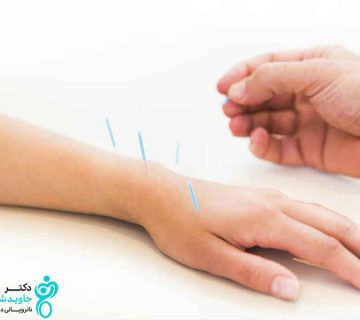 بررسی رابطه طب سوزنی و افزایش قد