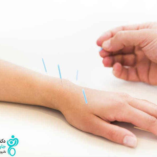 بررسی رابطه طب سوزنی و افزایش قد