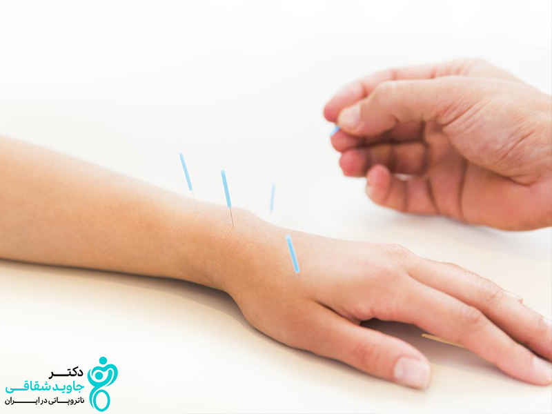 بررسی رابطه طب سوزنی و افزایش قد